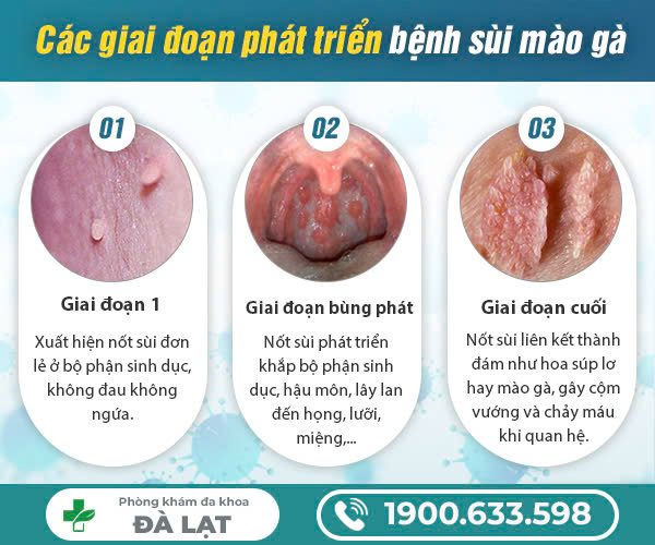 Hình ảnh minh họa